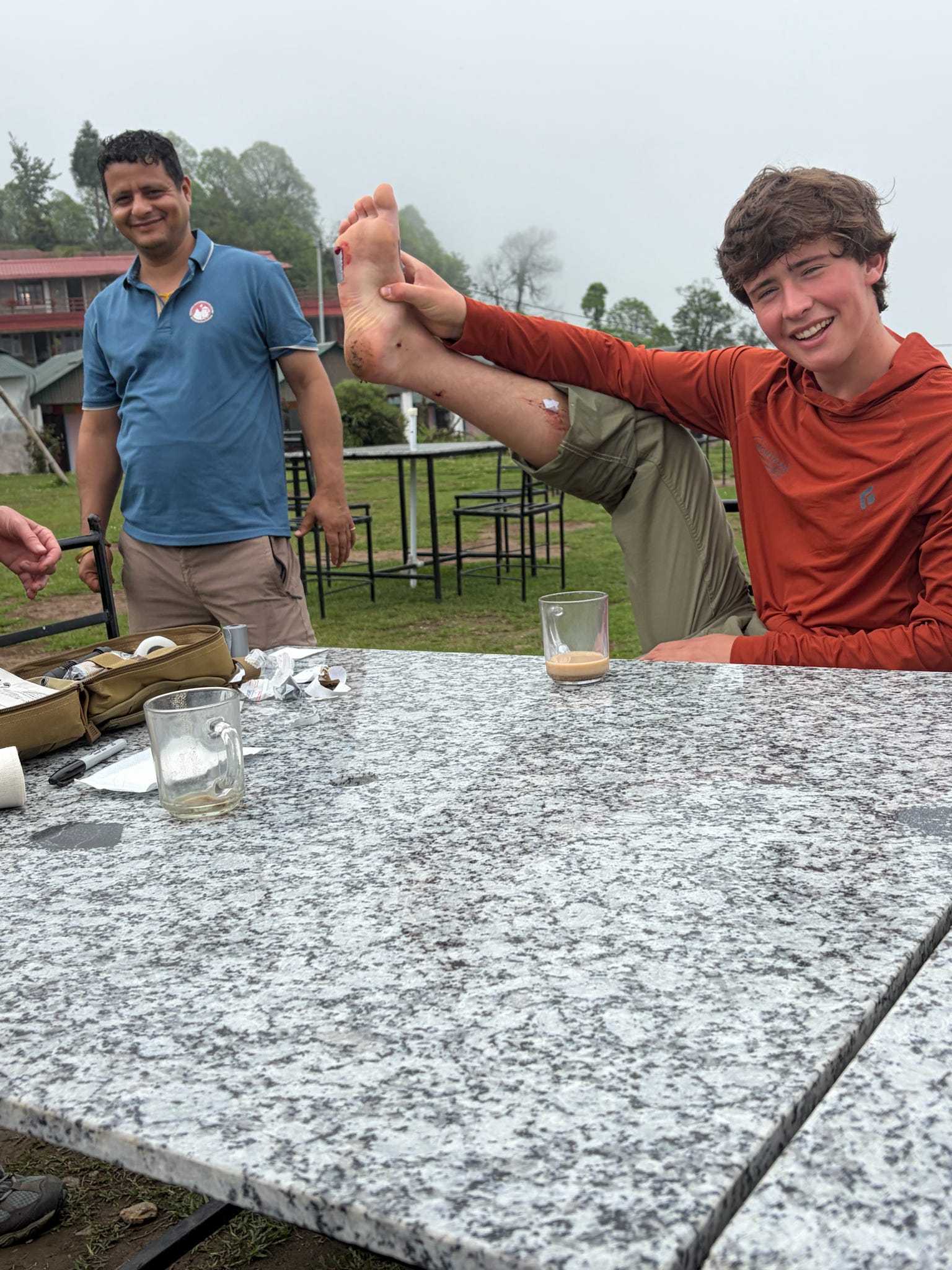 University of Montana student Noah Epps holds up his bandaged leg to display the damage done by the leeches. They seemed to have a particular affinity for Epps.  Photo by Emma White