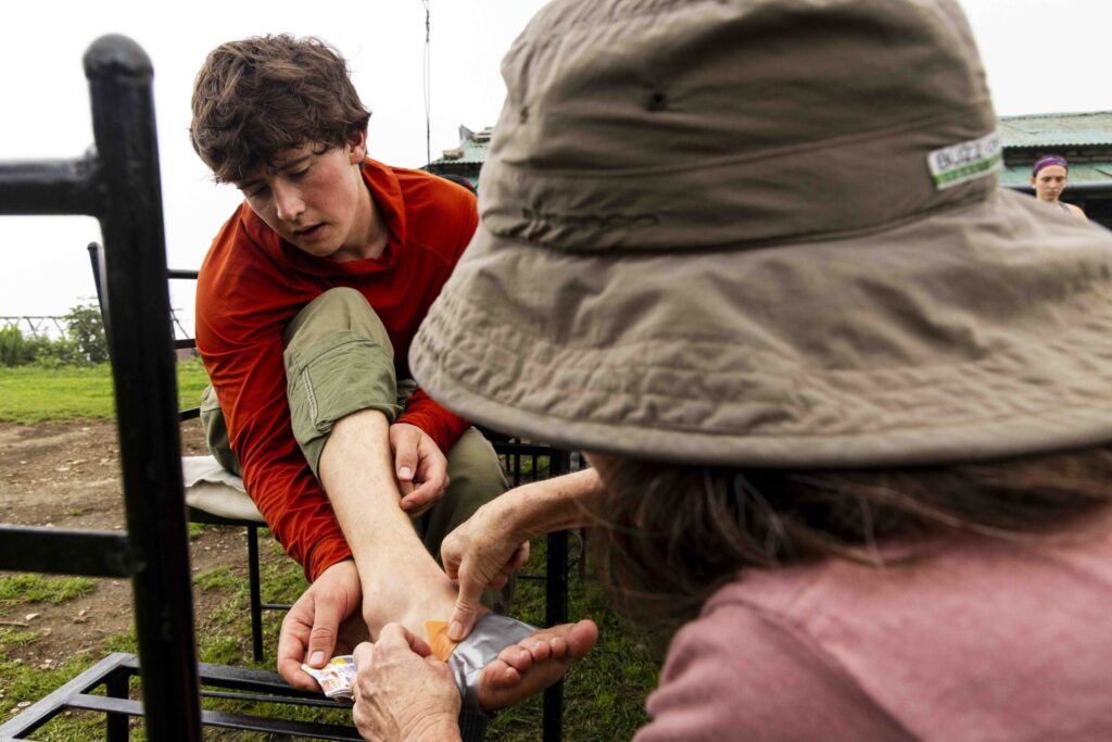 UM student Noah Epps stops the bleeding on his foot after being targeted by leeches on his hike. Photo by Marley Barboeisel